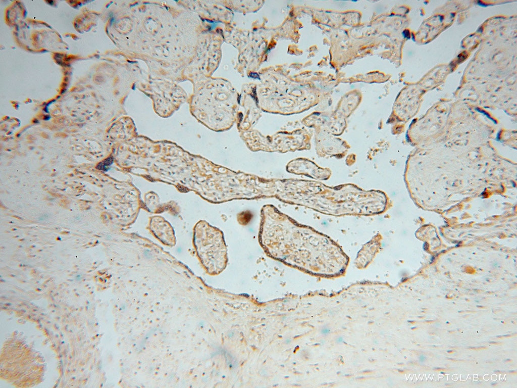 IHC staining of human placenta using 15359-1-AP