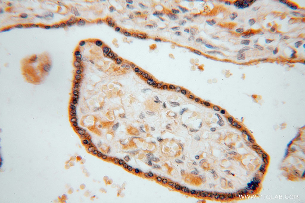 Immunohistochemistry (IHC) staining of human placenta tissue using TRIB2 Polyclonal antibody (15359-1-AP)