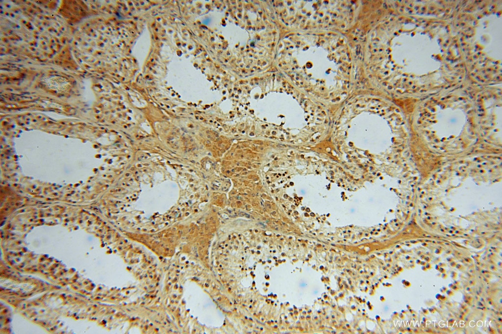 Immunohistochemistry (IHC) staining of human testis tissue using TRIB2 Polyclonal antibody (15359-1-AP)