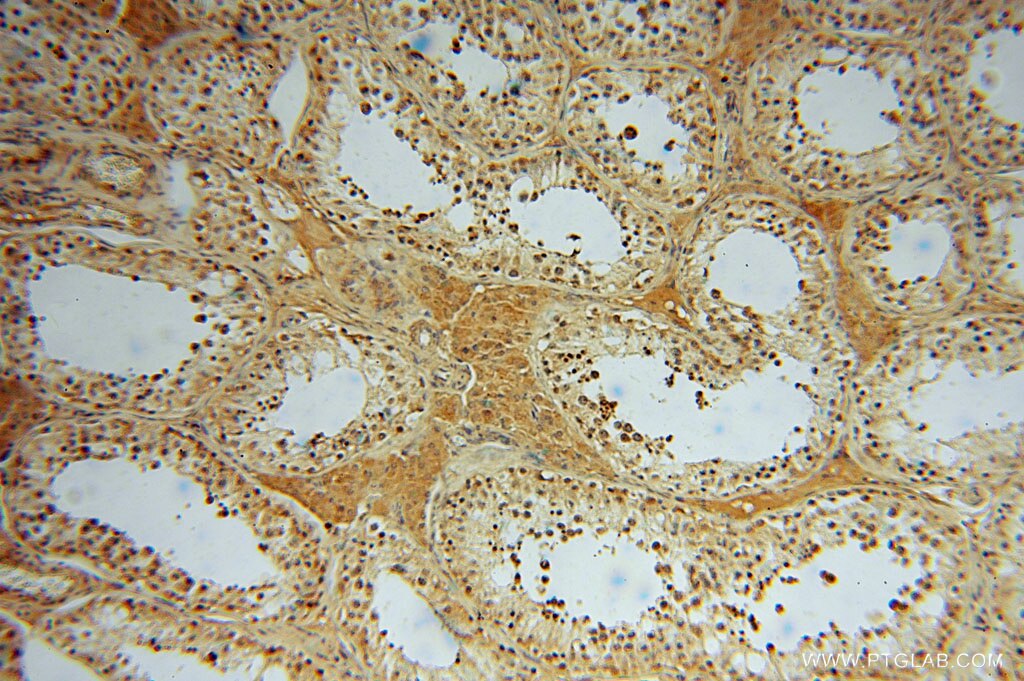 IHC staining of human testis using 15359-1-AP