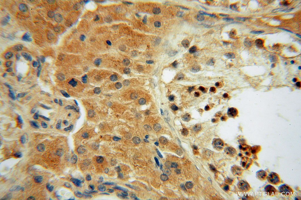 Immunohistochemistry (IHC) staining of human testis tissue using TRIB2 Polyclonal antibody (15359-1-AP)