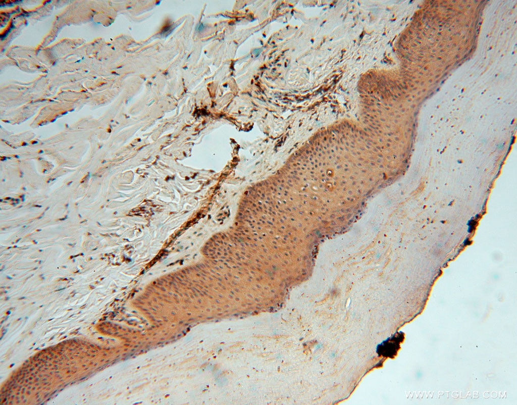 Immunohistochemistry (IHC) staining of human skin tissue using TRIB2 Polyclonal antibody (15359-1-AP)