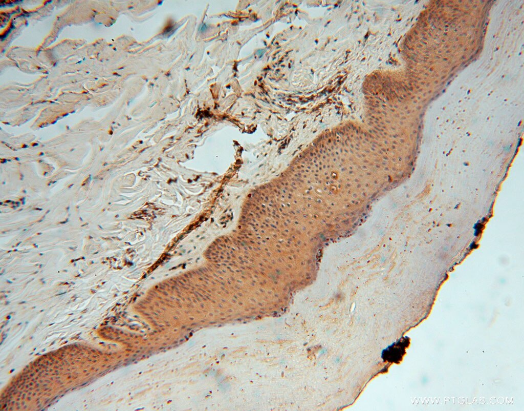 Immunohistochemistry (IHC) staining of human skin tissue using TRIB2 Polyclonal antibody (15359-1-AP)