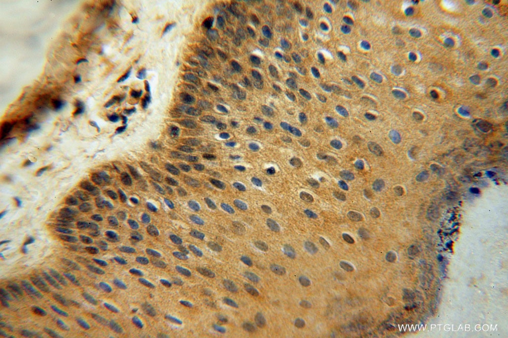 Immunohistochemistry (IHC) staining of human skin tissue using TRIB2 Polyclonal antibody (15359-1-AP)