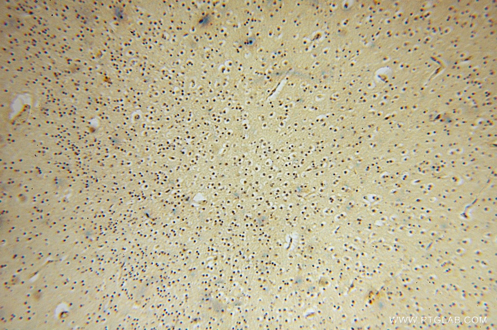 Immunohistochemistry (IHC) staining of human brain tissue using TRIB2 Polyclonal antibody (15359-1-AP)