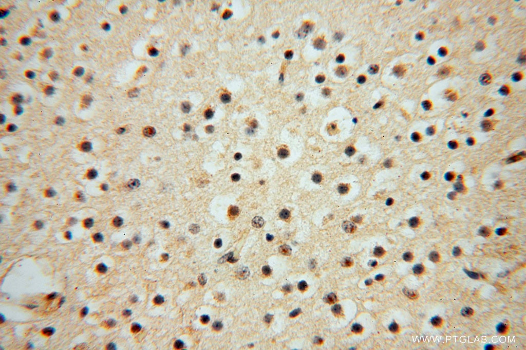 Immunohistochemistry (IHC) staining of human brain tissue using TRIB2 Polyclonal antibody (15359-1-AP)