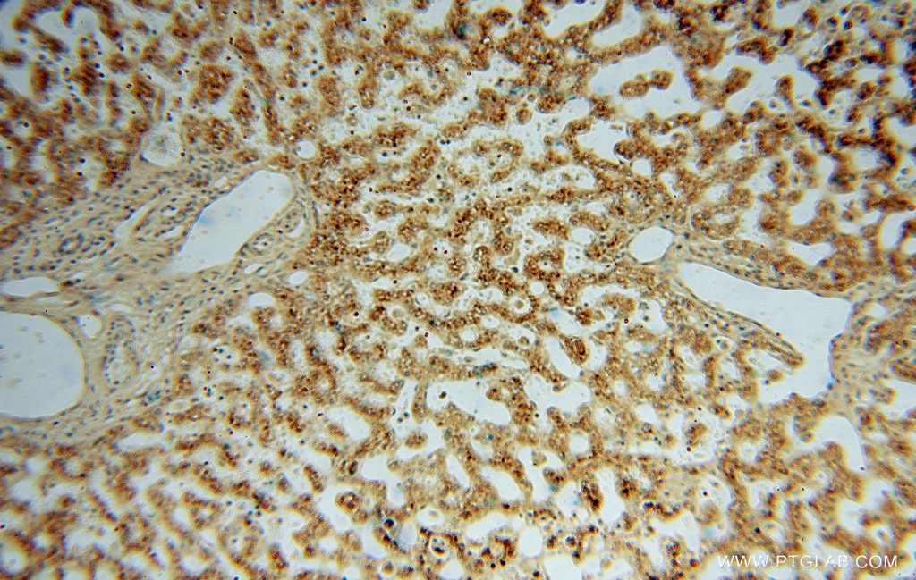 Immunohistochemistry (IHC) staining of human liver tissue using TRIB2 Polyclonal antibody (15359-1-AP)