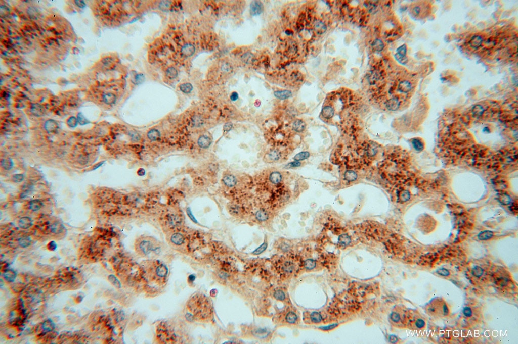 Immunohistochemistry (IHC) staining of human liver tissue using TRIB2 Polyclonal antibody (15359-1-AP)