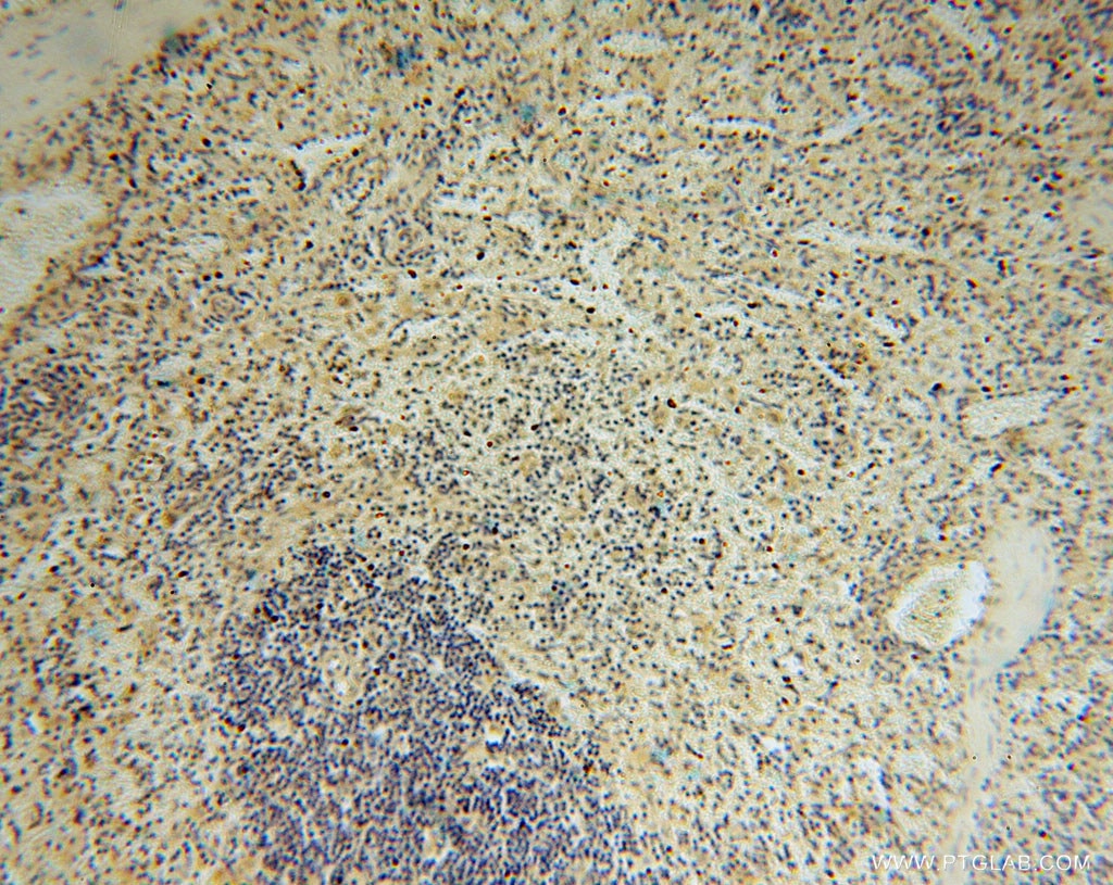 IHC staining of human spleen using 15359-1-AP