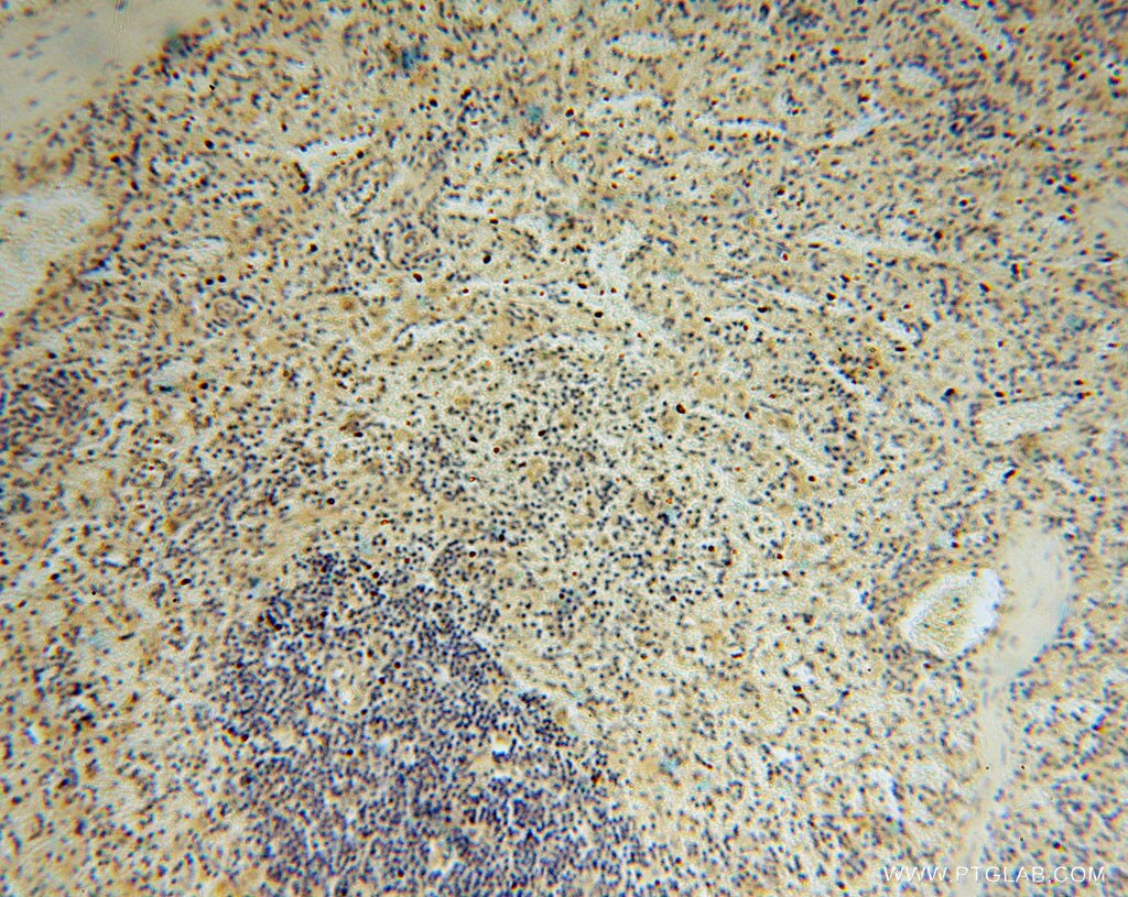 Immunohistochemistry (IHC) staining of human spleen tissue using TRIB2 Polyclonal antibody (15359-1-AP)