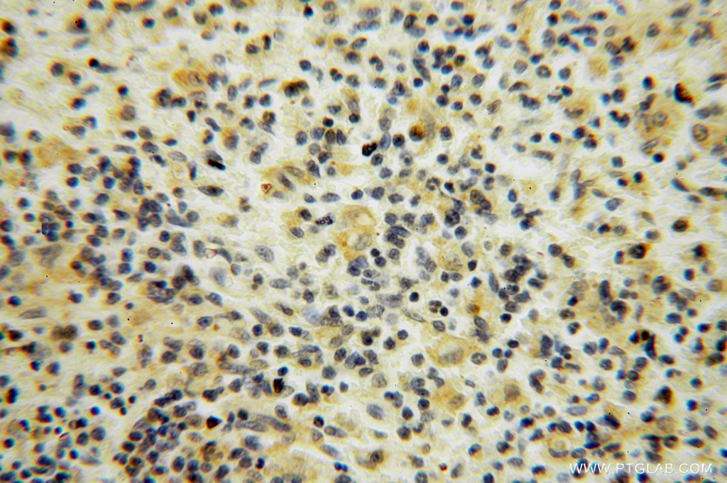 Immunohistochemistry (IHC) staining of human spleen tissue using TRIB2 Polyclonal antibody (15359-1-AP)