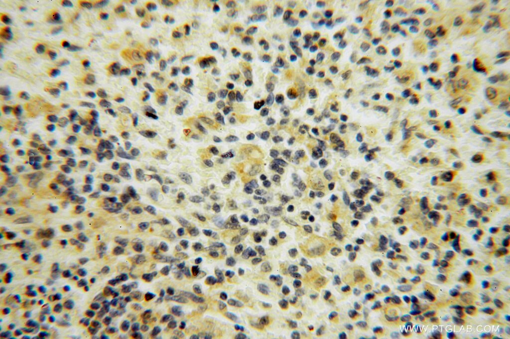 IHC staining of human spleen using 15359-1-AP