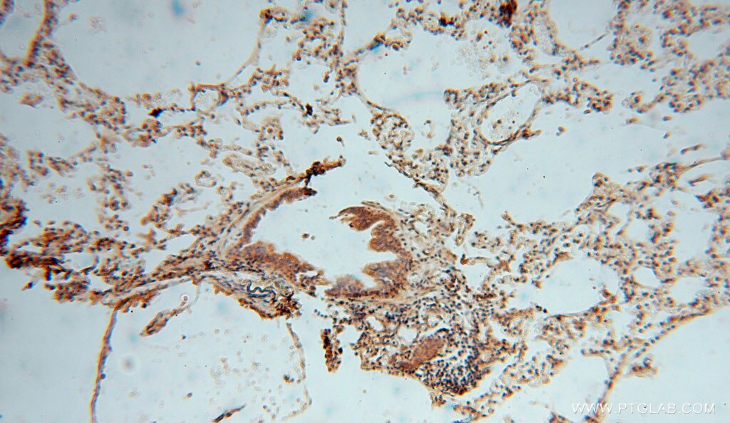 Immunohistochemistry (IHC) staining of human lung tissue using TRIB2 Polyclonal antibody (15359-1-AP)