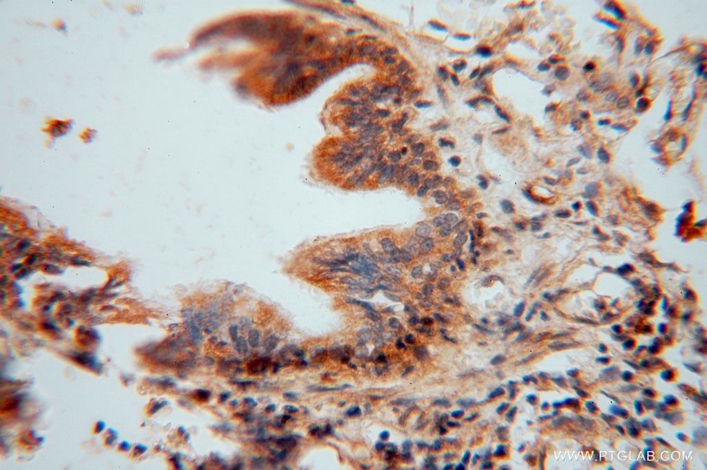 Immunohistochemistry (IHC) staining of human lung tissue using TRIB2 Polyclonal antibody (15359-1-AP)