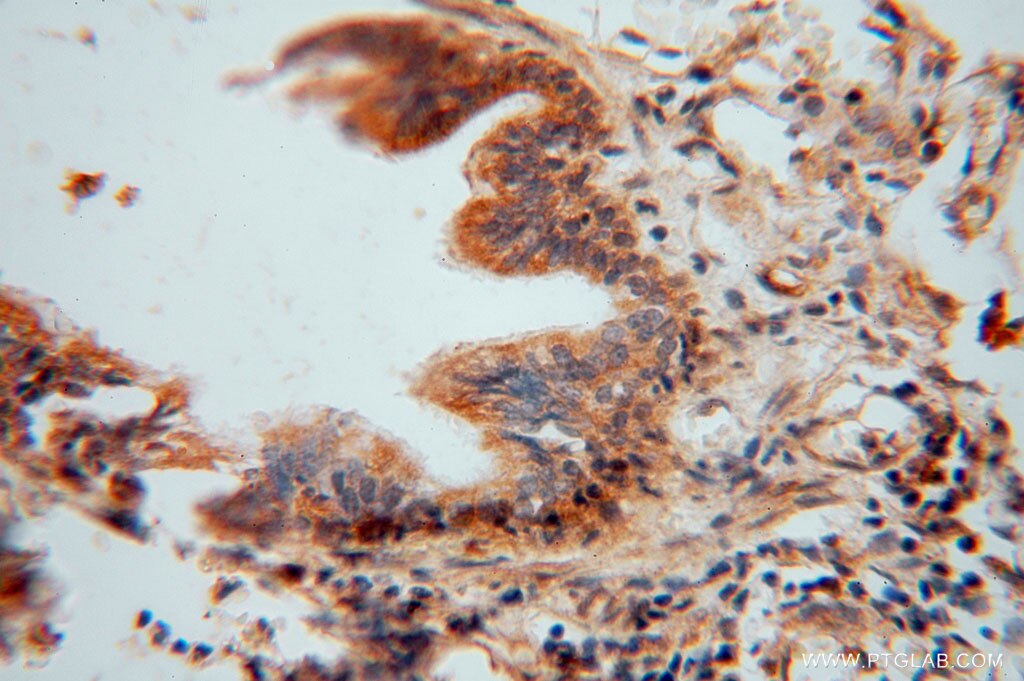 IHC staining of human lung using 15359-1-AP