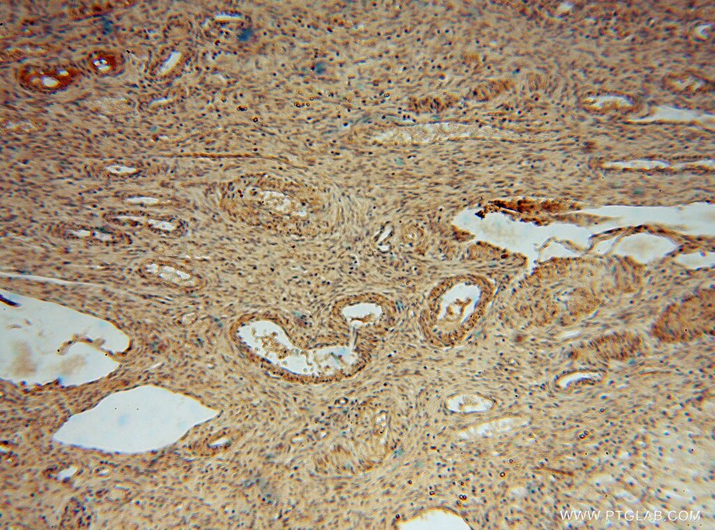 Immunohistochemistry (IHC) staining of human ovary tissue using TRIB2 Polyclonal antibody (15359-1-AP)
