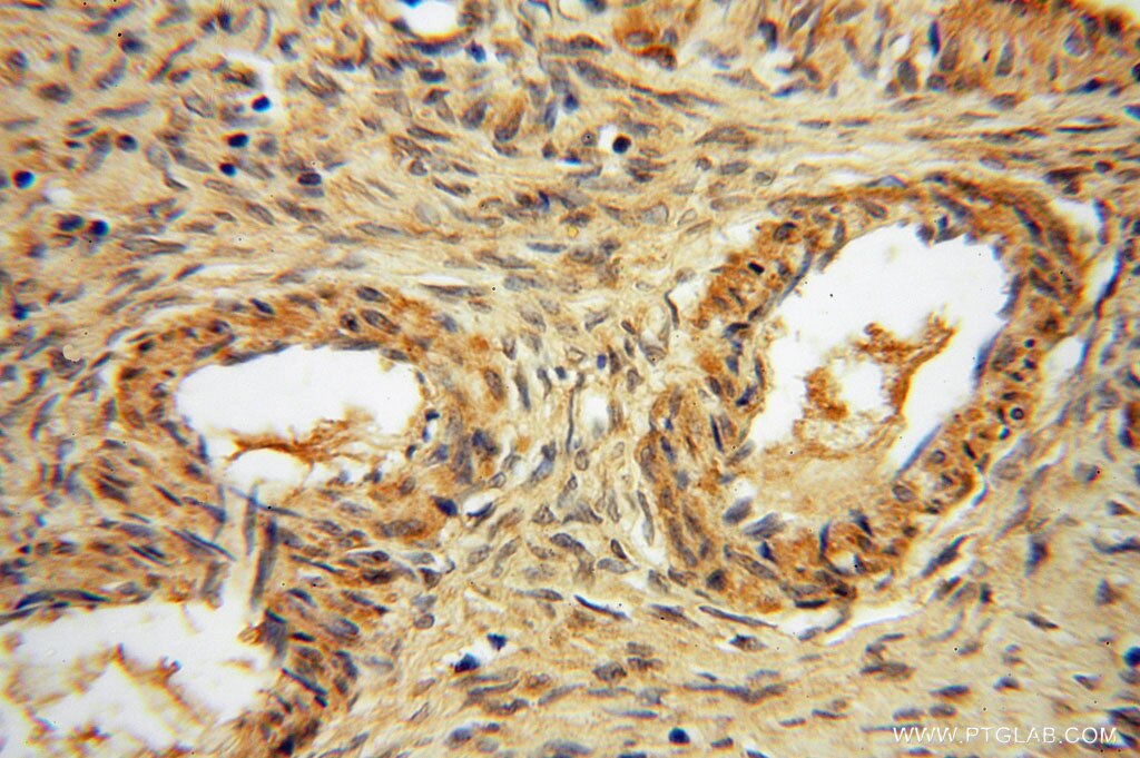 IHC staining of human ovary using 15359-1-AP