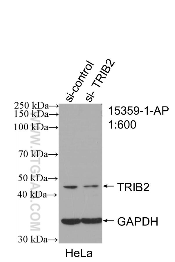 Western Blot (WB) analysis of HeLa cells using TRIB2 Polyclonal antibody (15359-1-AP)