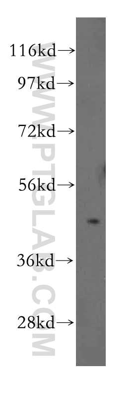 Western Blot (WB) analysis of Jurkat cells using TRIB2 Polyclonal antibody (15359-1-AP)