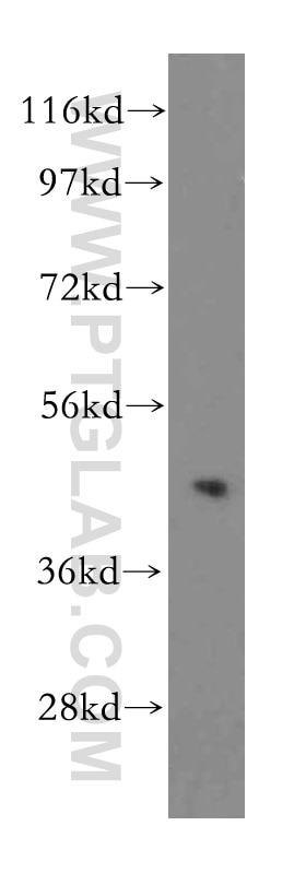 Western Blot (WB) analysis of HeLa cells using TRIB2 Polyclonal antibody (15359-1-AP)