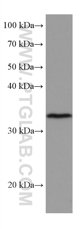 WB analysis of RAW 264.7 using 67171-1-Ig