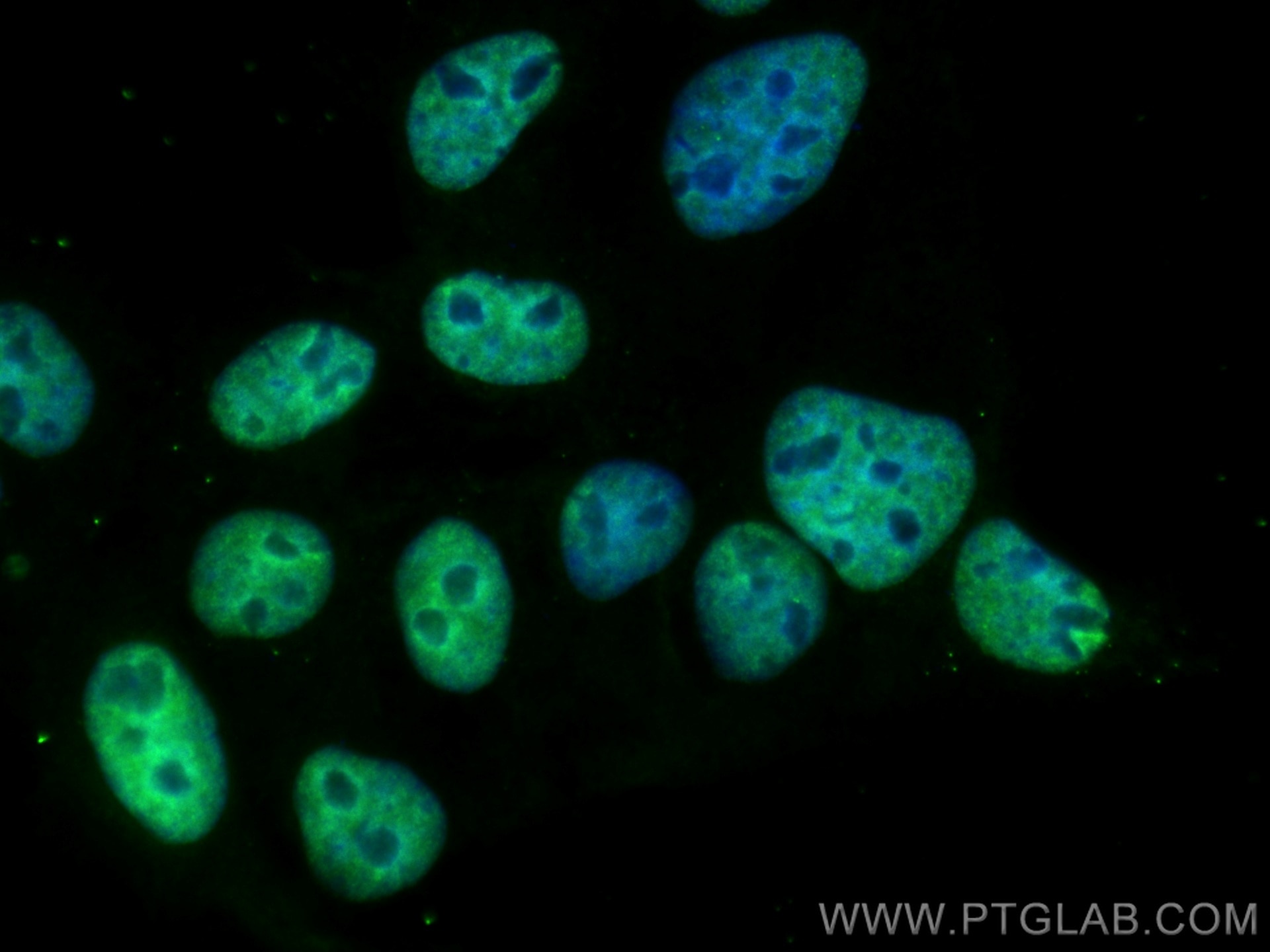 Immunofluorescence (IF) / fluorescent staining of A431 cells using CoraLite® Plus 488-conjugated TRIB2 Monoclonal ant (CL488-67171)