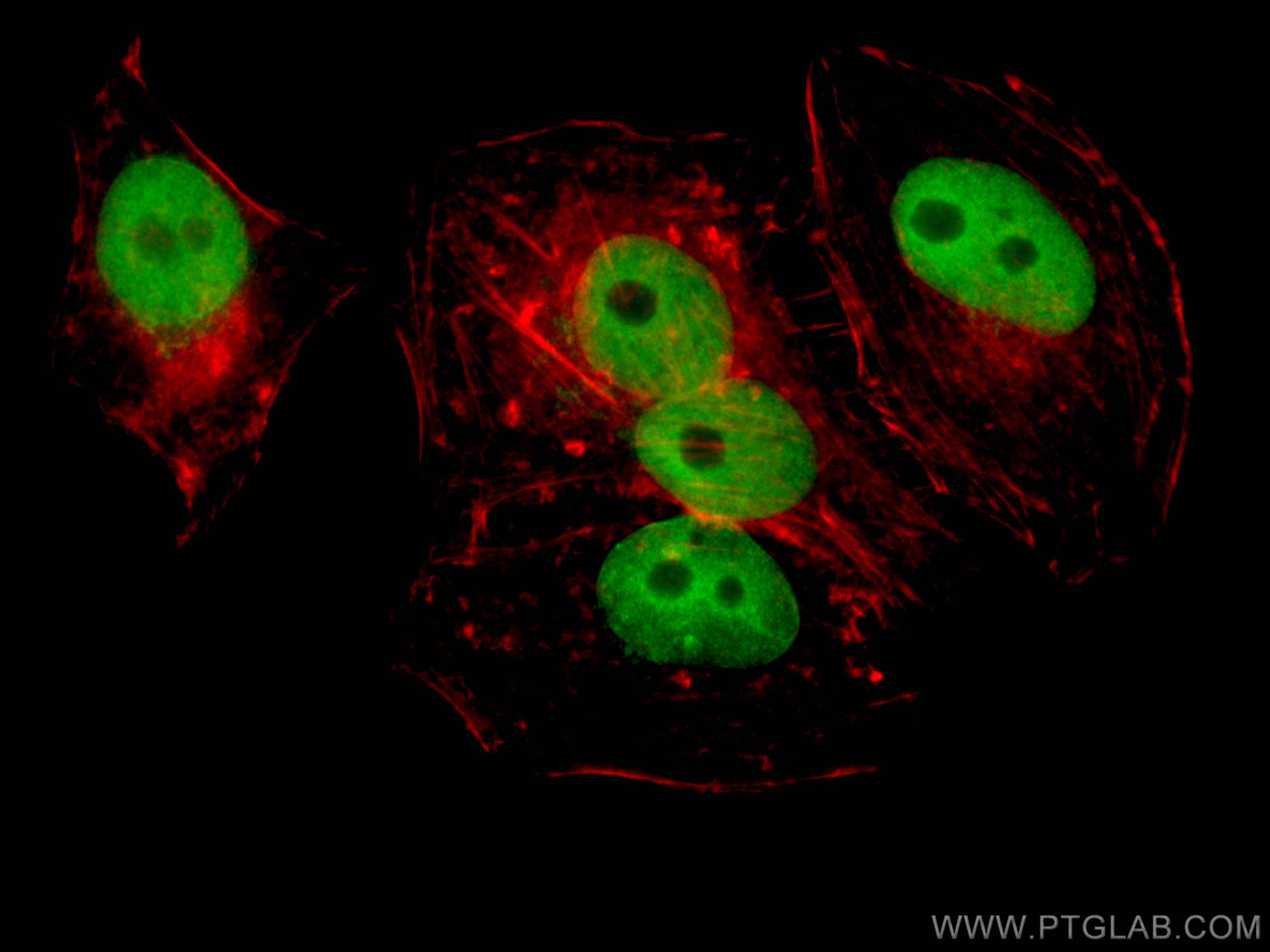Immunofluorescence (IF) / fluorescent staining of HepG2 cells using TRIB3 Polyclonal antibody (13300-1-AP)