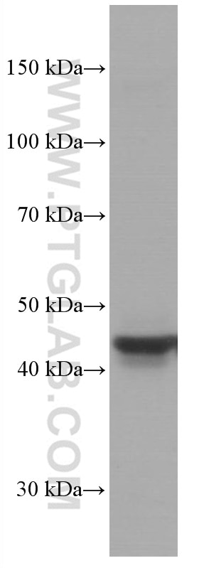 WB analysis of rat liver using 66702-1-Ig