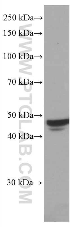 Western Blot (WB) analysis of LNCaP cells using TRIB3 Monoclonal antibody (66702-1-Ig)