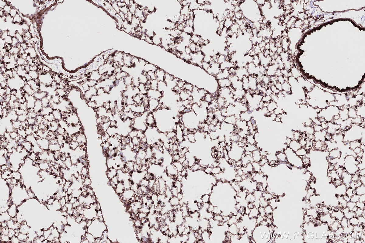 Immunohistochemistry (IHC) staining of mouse lung tissue using TRIM11 Polyclonal antibody (10851-1-AP)