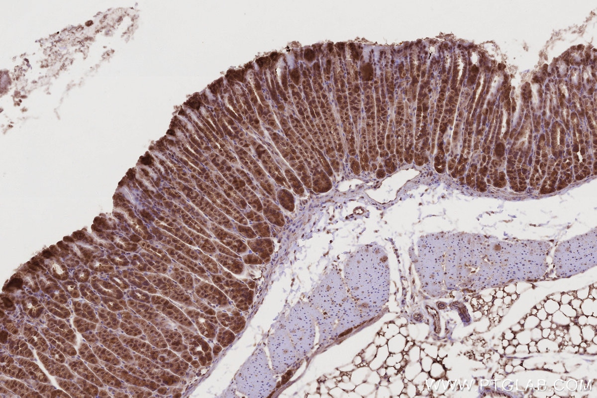 Immunohistochemistry (IHC) staining of mouse stomach tissue using TRIM11 Polyclonal antibody (10851-1-AP)