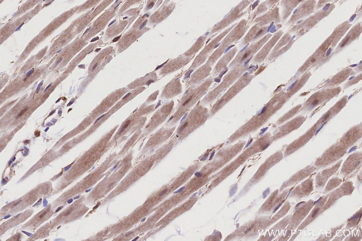 Immunohistochemistry (IHC) staining of rat heart tissue using TRIM11 Polyclonal antibody (10851-1-AP)