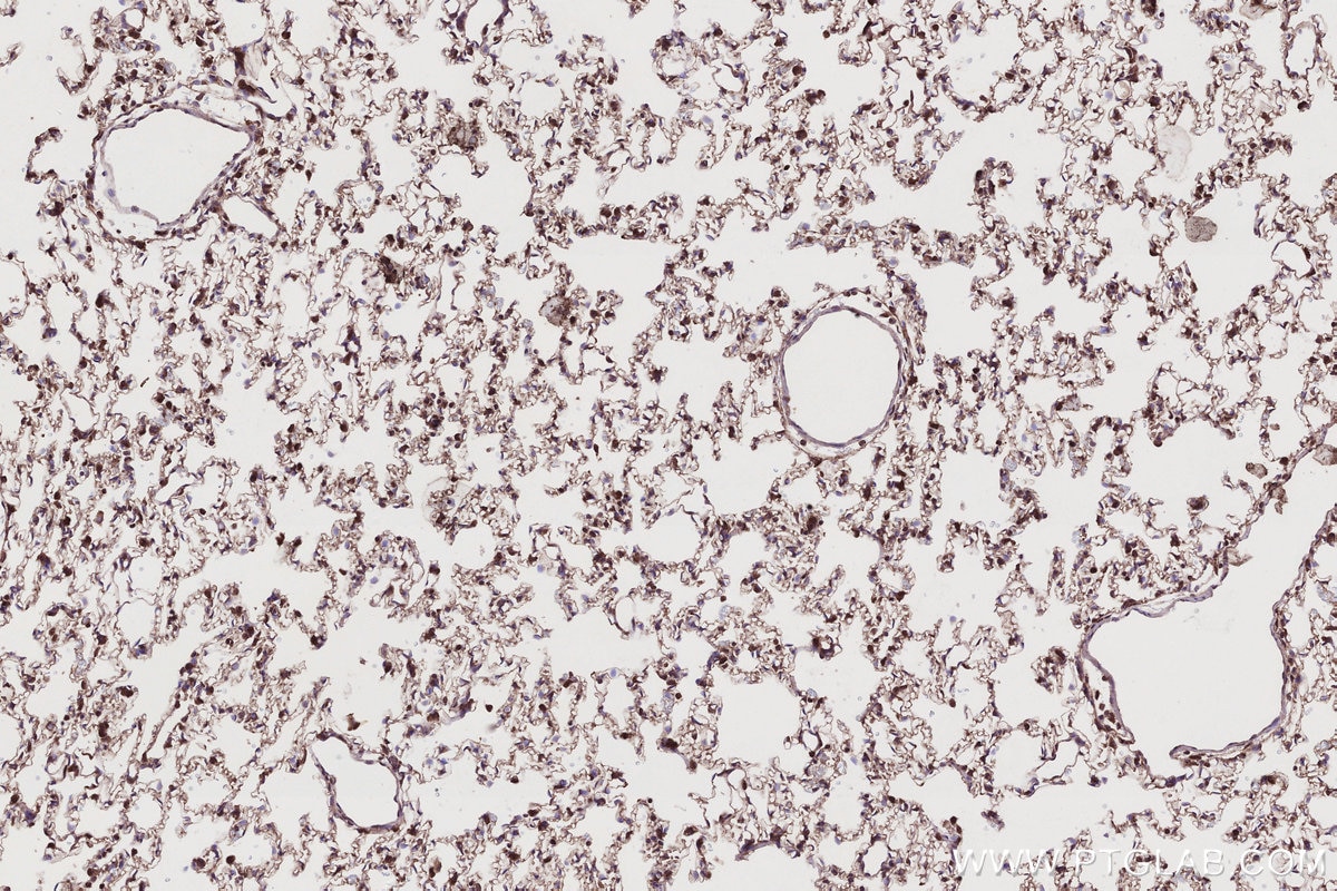 Immunohistochemistry (IHC) staining of rat lung tissue using TRIM11 Polyclonal antibody (10851-1-AP)