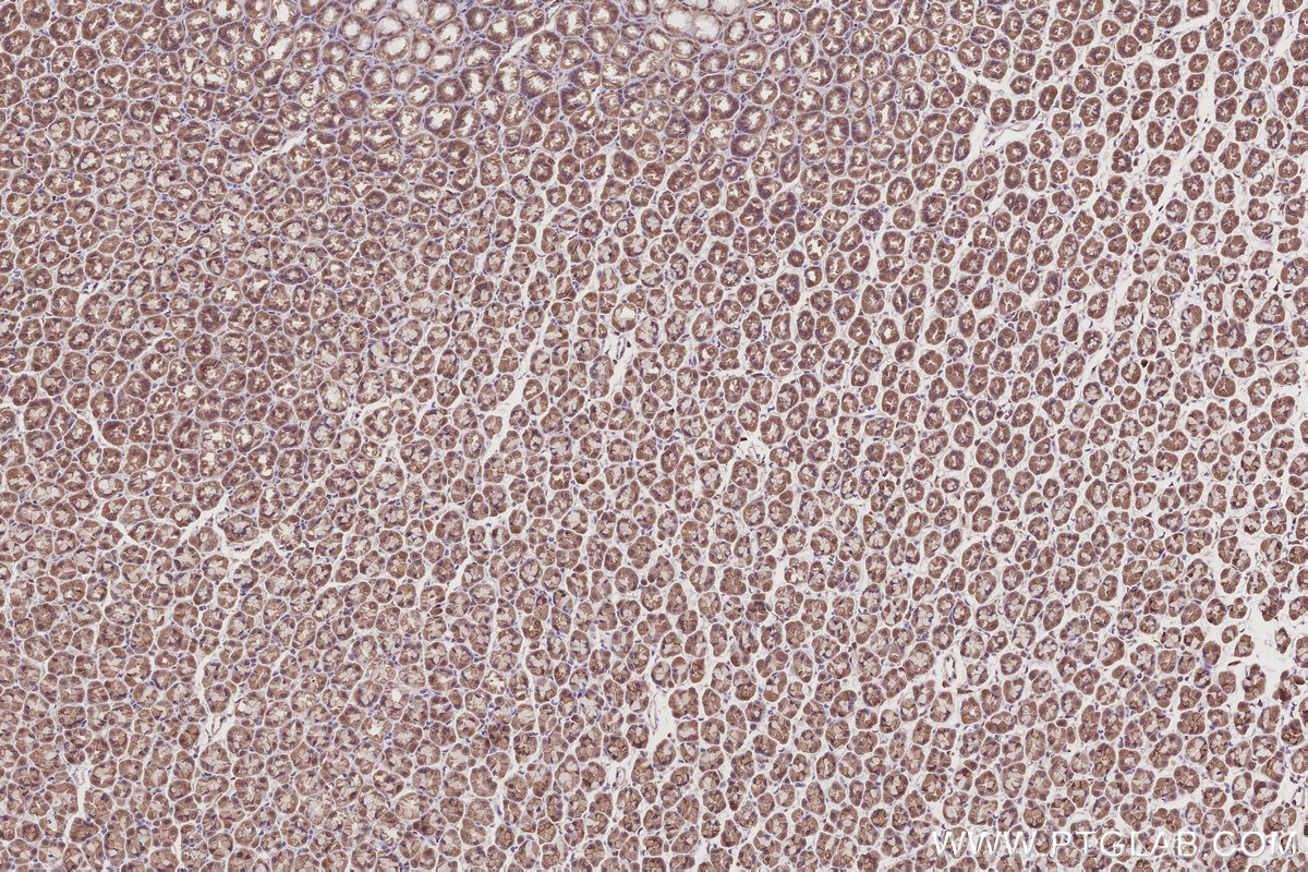 Immunohistochemistry (IHC) staining of rat stomach tissue using TRIM11 Polyclonal antibody (10851-1-AP)