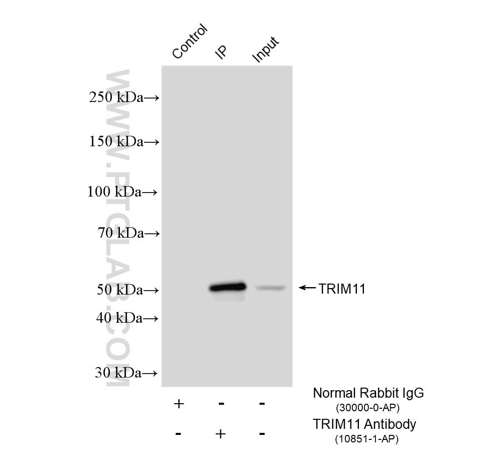 IP result of anti-TRIM11 (IP:10851-1-AP, 4ug; Detection:10851-1-AP 1:1000) with HeLa cells lysate 1080 ug. Immunoprecipitation (IP) experiment of HeLa cells using TRIM11 Polyclonal antibody (10851-1-AP)
