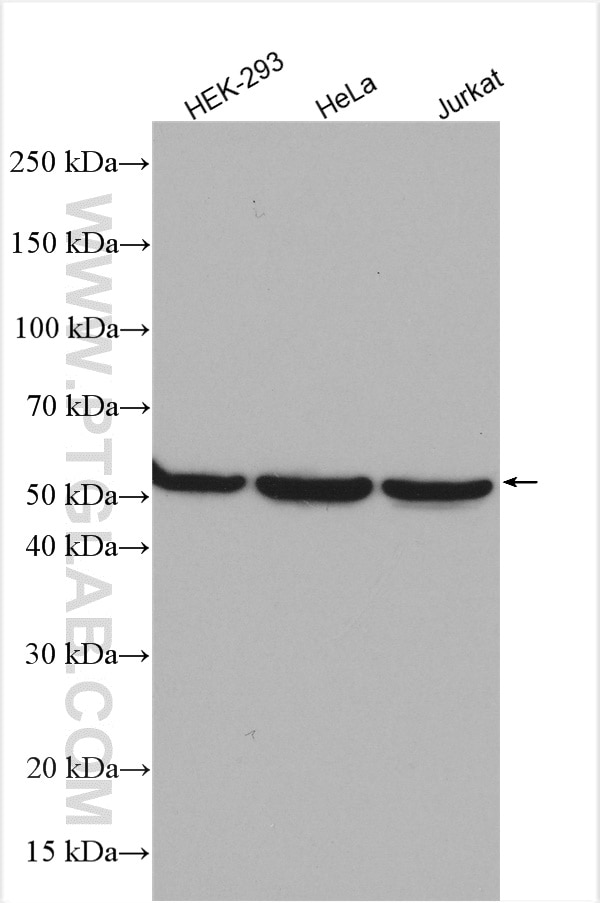 Western Blot (WB) analysis of various lysates using TRIM11 Polyclonal antibody (10851-1-AP)