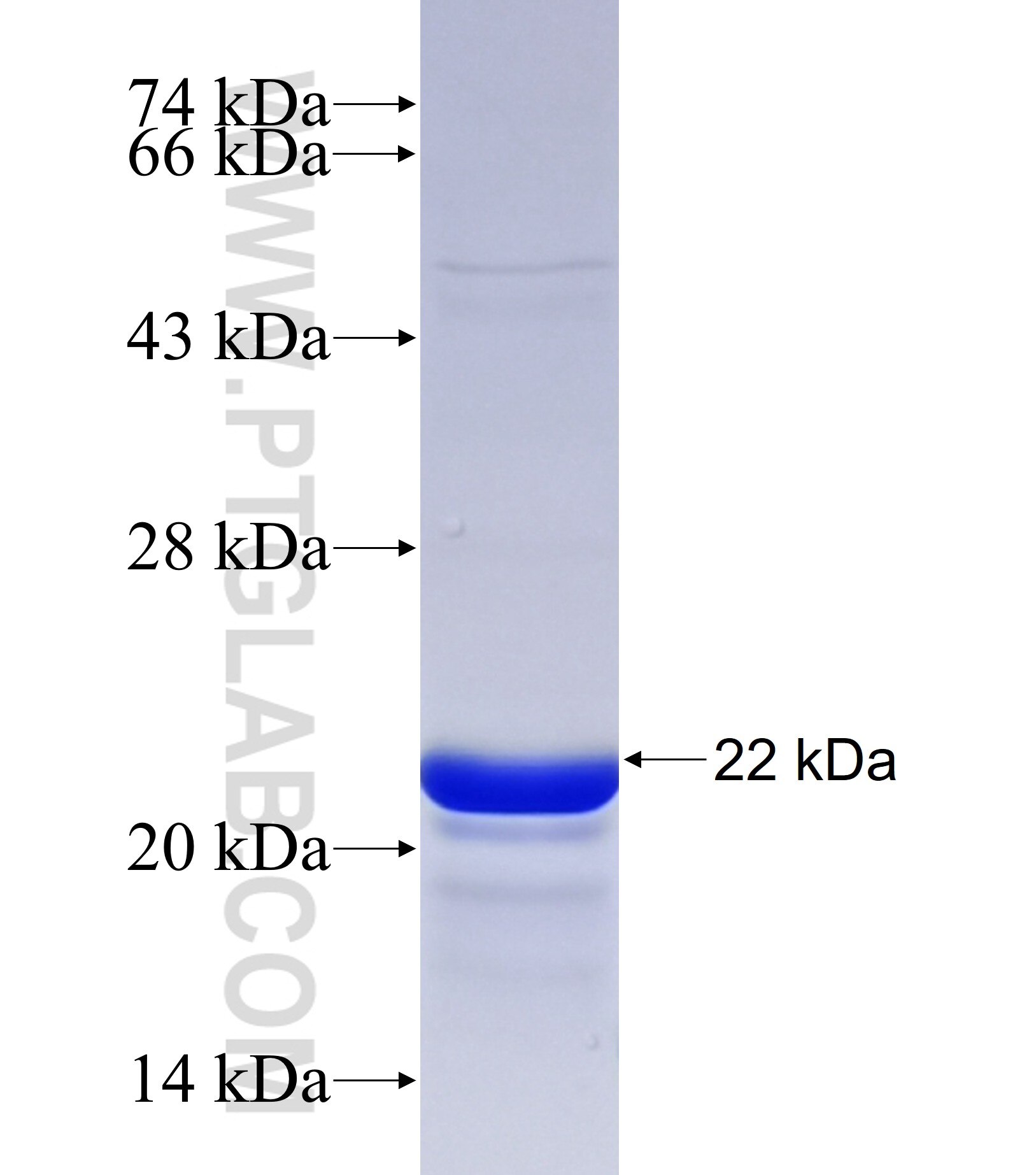 TRIM11 fusion protein Ag41943 SDS-PAGE TRIM11 fusion protein Ag41943 SDS-PAGE