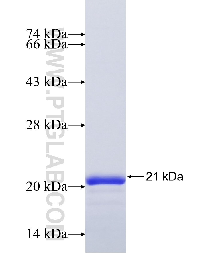 TRIM11 fusion protein Ag41944 SDS-PAGE