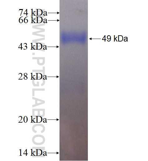 TRIM11 fusion protein Ag1308 SDS-PAGE