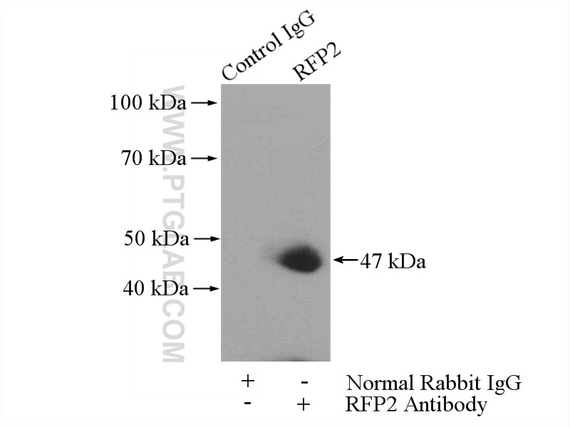 Immunoprecipitation (IP) experiment of Jurkat cells using RFP2 Polyclonal antibody (22021-1-AP)