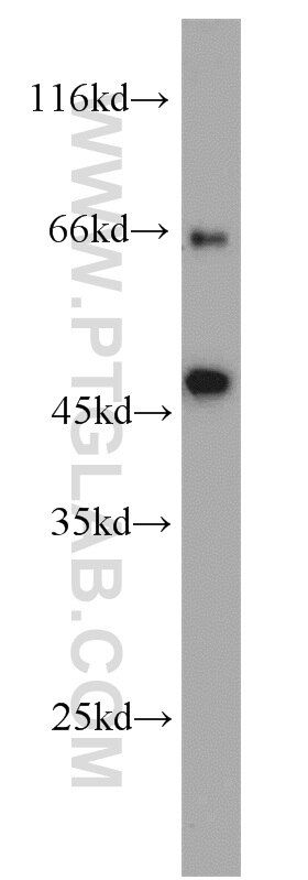 Western Blot (WB) analysis of Jurkat cells using RFP2 Polyclonal antibody (22021-1-AP)