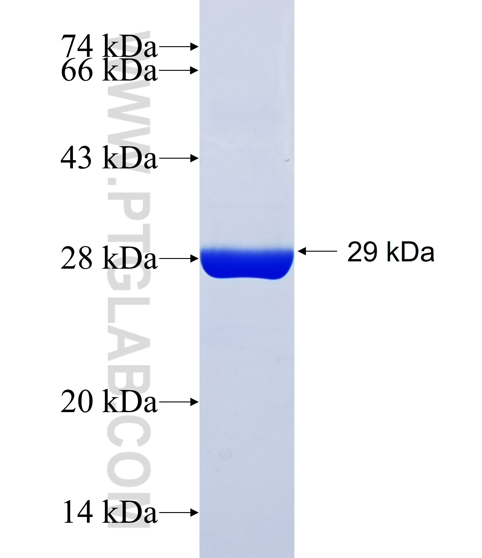 TRIM13 fusion protein Ag34469 SDS-PAGE TRIM13 fusion protein Ag34469 SDS-PAGE