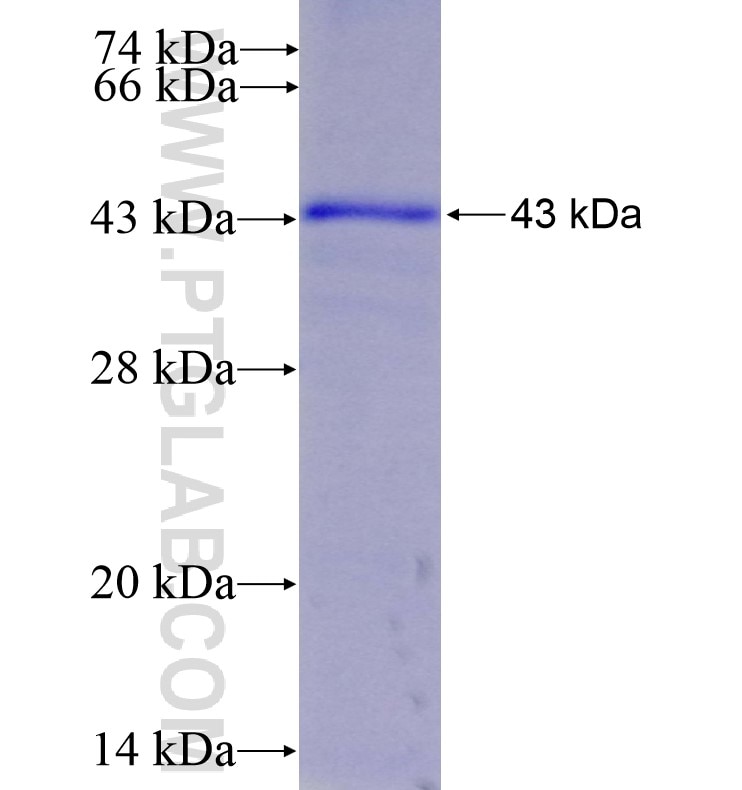 TRIM13 fusion protein Ag16805 SDS-PAGE