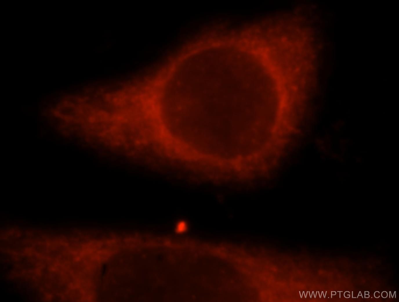 Immunofluorescence (IF) / fluorescent staining of HeLa cells using TRIM14 Polyclonal antibody (15742-1-AP)