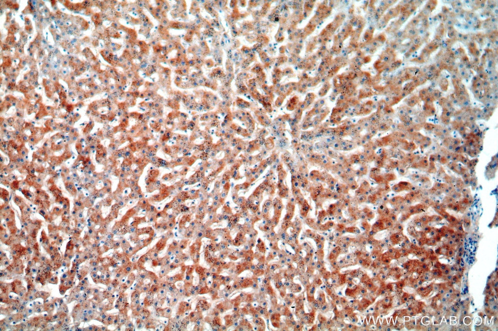 Immunohistochemistry (IHC) staining of human liver tissue using TRIM14 Polyclonal antibody (15742-1-AP)