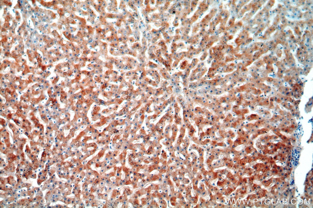 IHC staining of human liver using 15742-1-AP