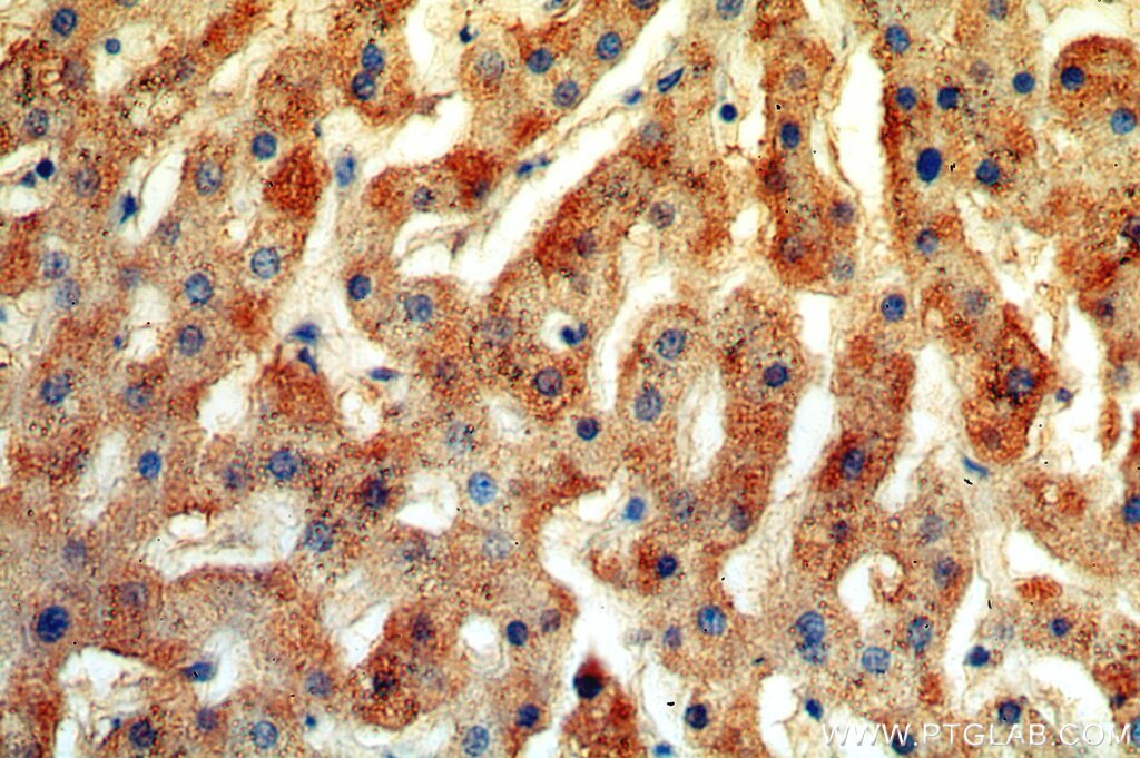 Immunohistochemistry (IHC) staining of human liver tissue using TRIM14 Polyclonal antibody (15742-1-AP)