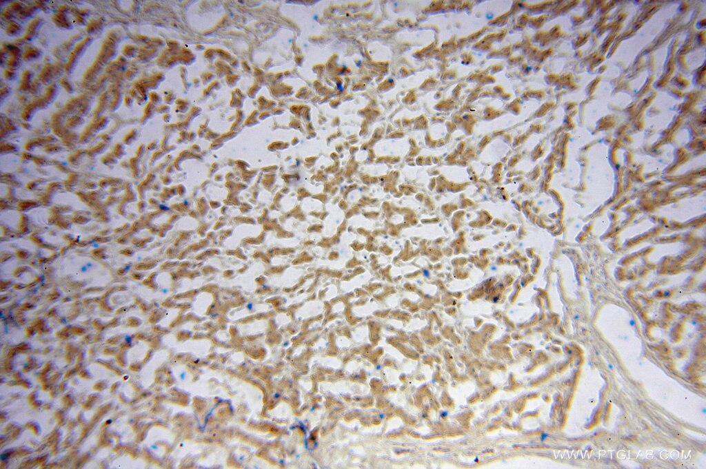 Immunohistochemistry (IHC) staining of human liver tissue using TRIM14 Polyclonal antibody (15742-1-AP)