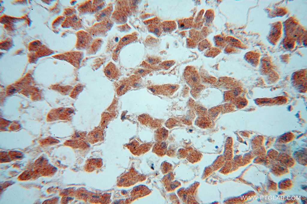 Immunohistochemistry (IHC) staining of human liver tissue using TRIM14 Polyclonal antibody (15742-1-AP)