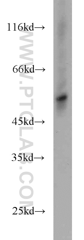 Western Blot (WB) analysis of Jurkat cells using TRIM15 Polyclonal antibody (13623-1-AP)